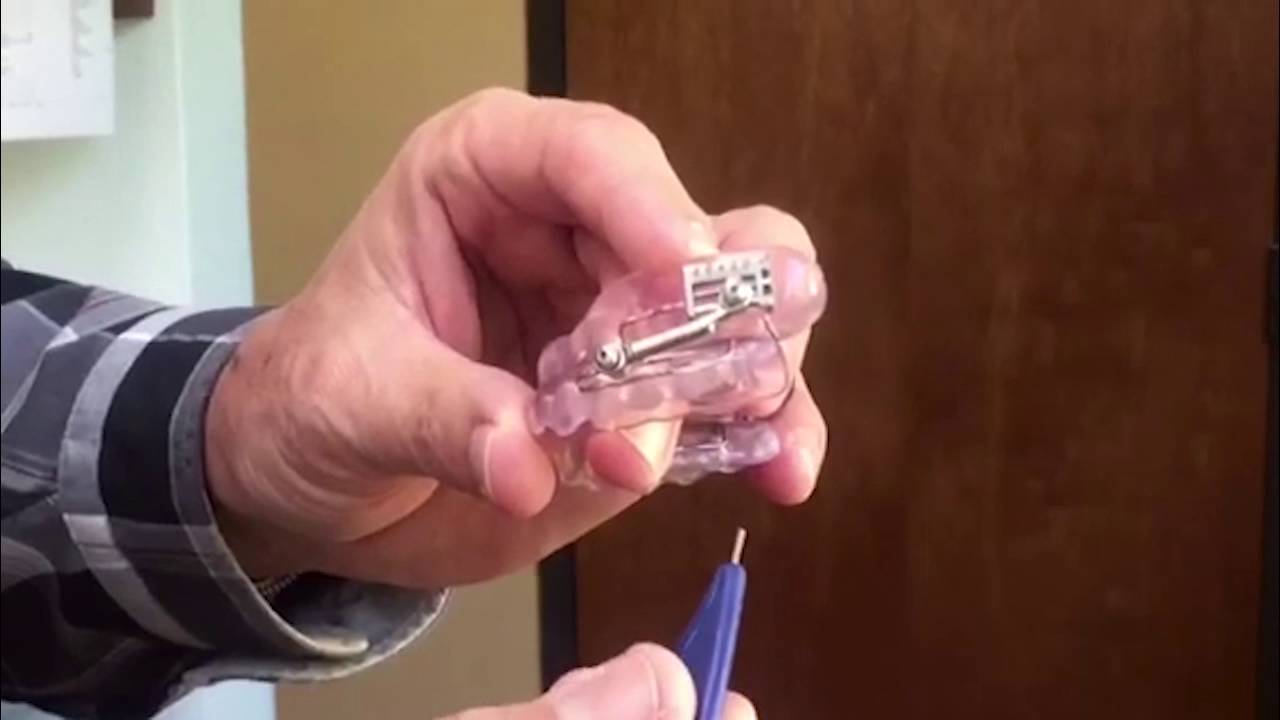 How to Adjust Your Herbst Appliance YouTube