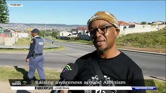 Thumbnail for Raising awareness around Albinism
