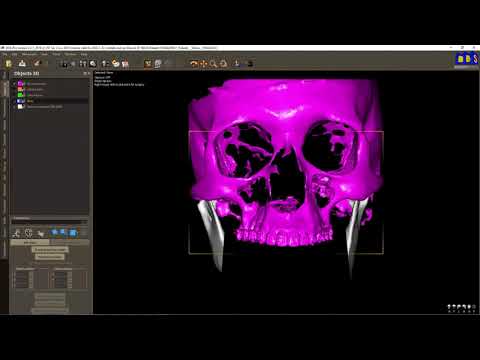 DDS Pro 008
