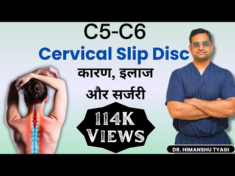 C5-6 Cervical Slip Disc - कारण, इलाज और सर्जरी।
