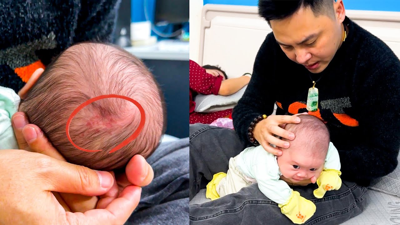 Tension Grows as Baby Banh Bao’s Parents Argue About Her Birthmark