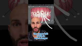 What to do if your two front teeth are different sizes.