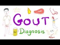 Gout Diagnosis
