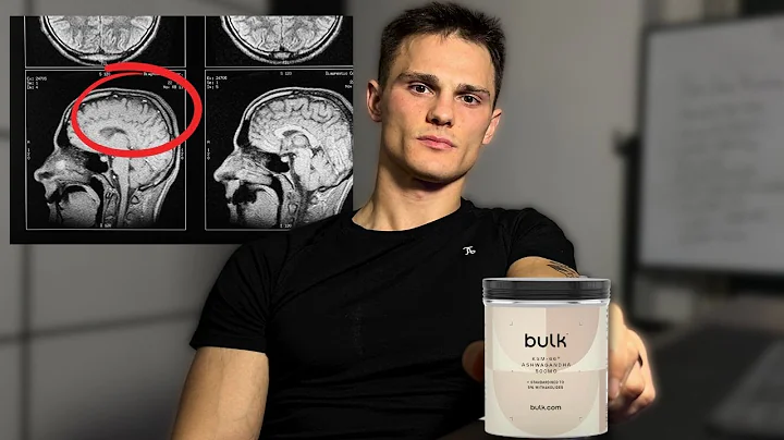 My Horrible Experience With Ashwagandha