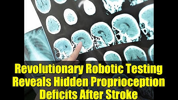 Revolutionary Robotic Testing Reveals Hidden Proprioception Deficits After Stroke