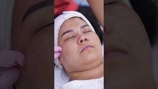 Yuzdagi dog’larni davolash#uzbekistan #cosmetologia #davo