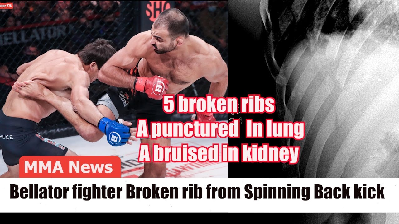 MMA News Bellator fighter Broken rib from Spinning Back kick at ...
