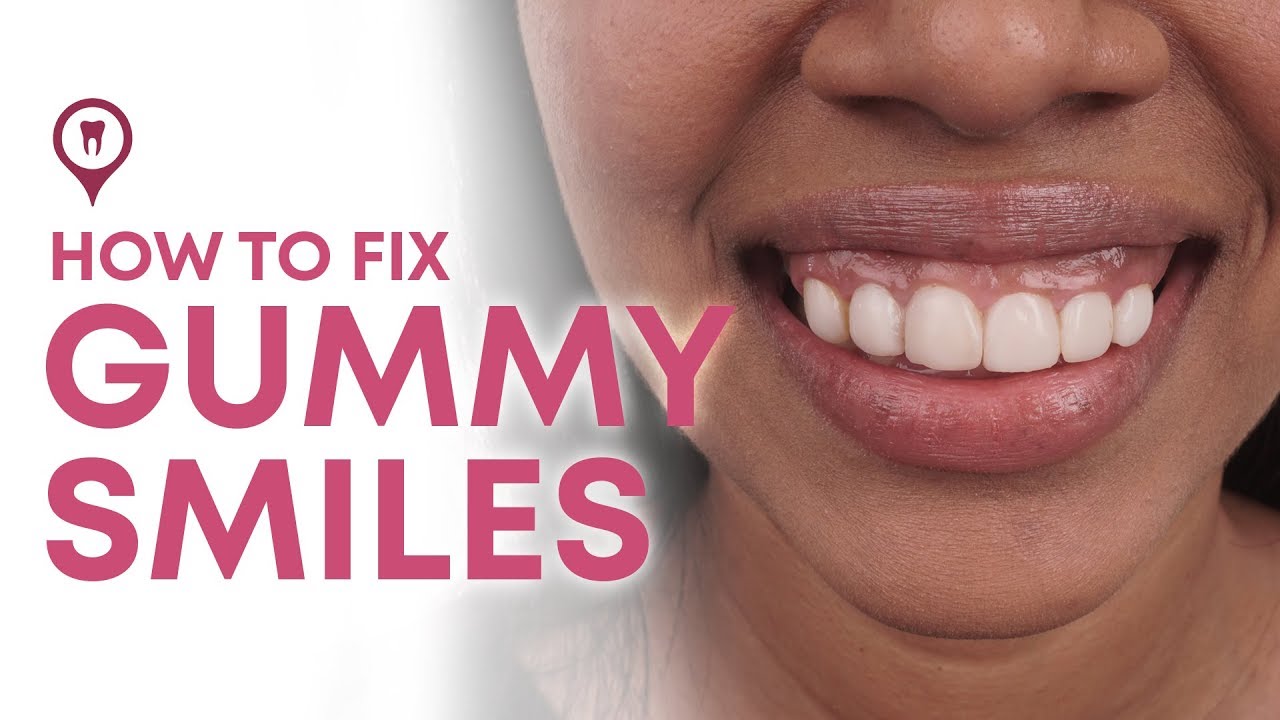 The Best Solution To Your Gummy Smile | Dr. Reuben Sim