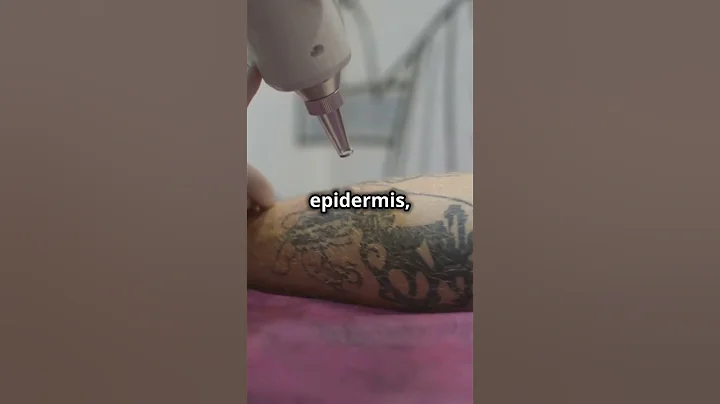 Why Tattoos Don't Disappear! [fact]