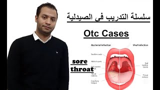 OTC Conditions - sore throat