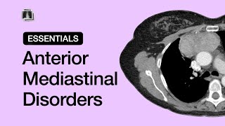 Anterior Mediastinal Disorders | Chest Radiology Essentials