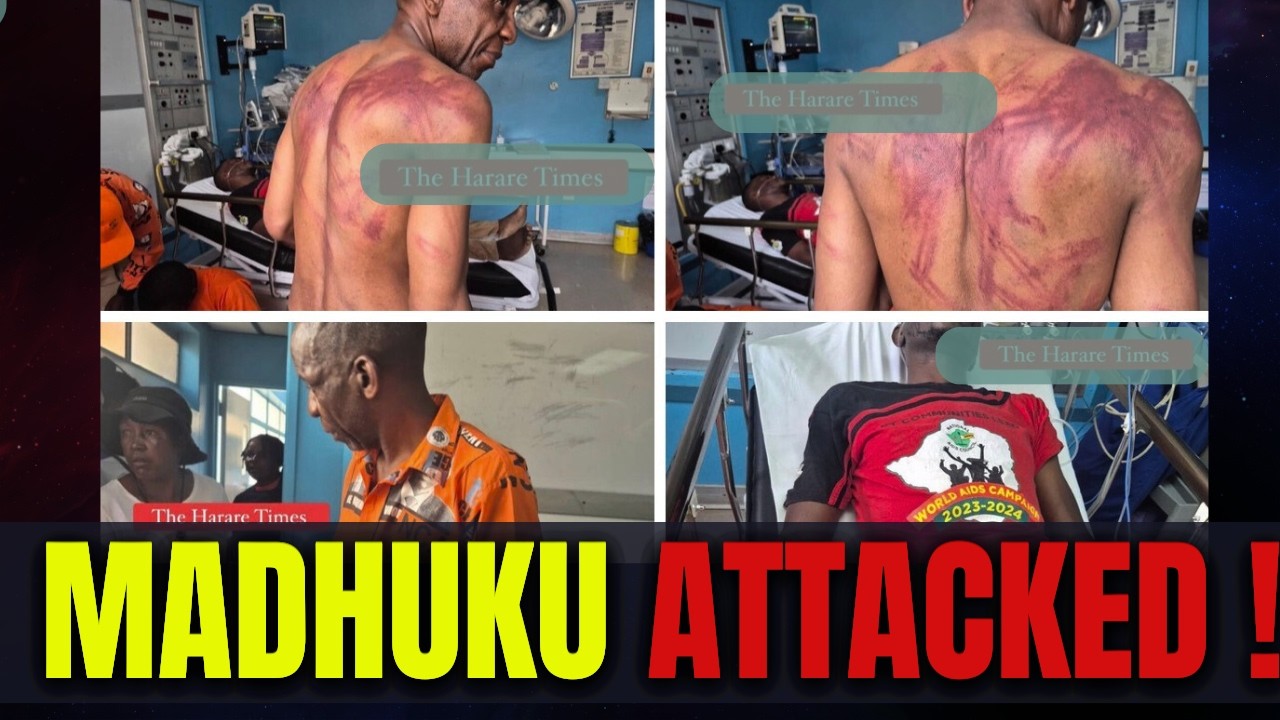 #breakingnews Prof Madhuku Brutally Attacked by Mnangagwa's Thugs!