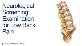 Neurological Screening Examination for Low Back Pain