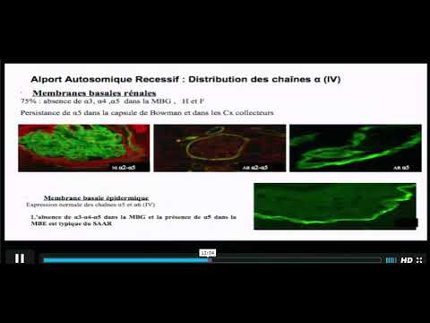 Vidéo: En quoi la membrane basale diffère-t-elle du sous-cutané ?