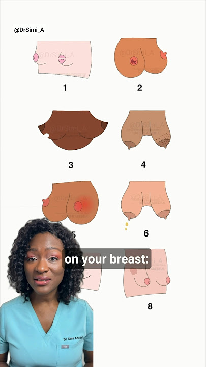 Don't Ignore These 8 Signs On Your Breast
