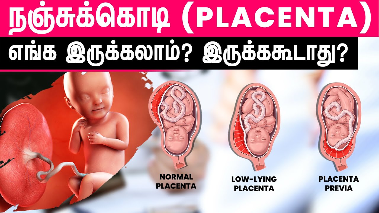 Placental Positions | நஞ்சுக்கொடி | Nanju kodi | Dr. Priya Kalyani