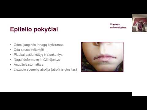 Video: Leukemija Ir Anemija: Kas Sieja?