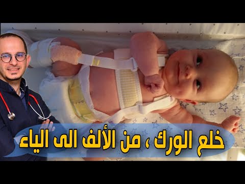 خلع الورك كل ما تحتاج معرفته عن خلع الولادة