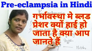 Preeclampsia lecture in hindi | प्रीएक्लेम्पसिया | Types & causes | Hypertension,protienurea,oedema