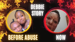 Her Boyfriend Poured Hot Cooking Oil On Her Face😭 - Deborah Wangeci Story