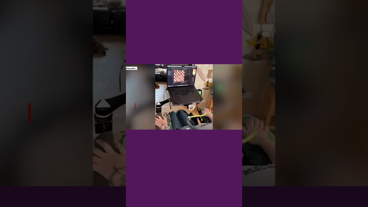 Paralyzed man plays chess with his mind using Elon Musk's Neuralink brain-chip