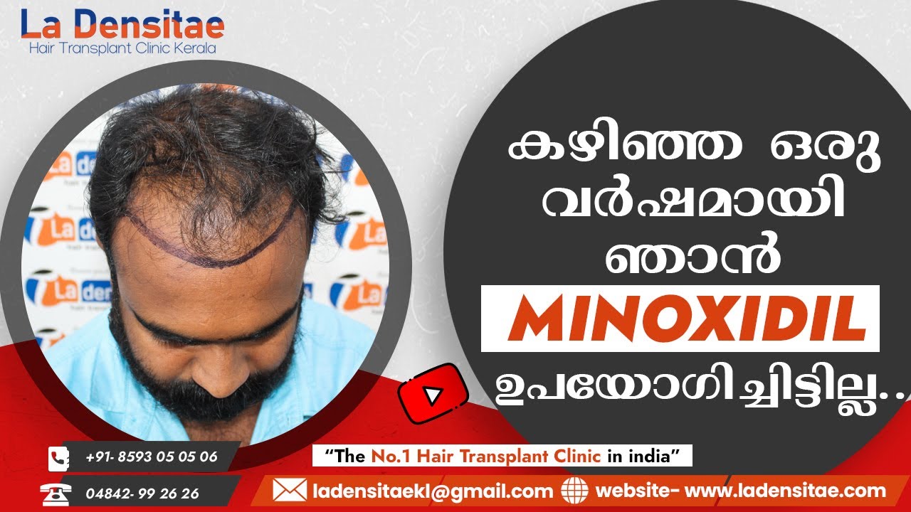 BHC Hair Transplant  Kochi