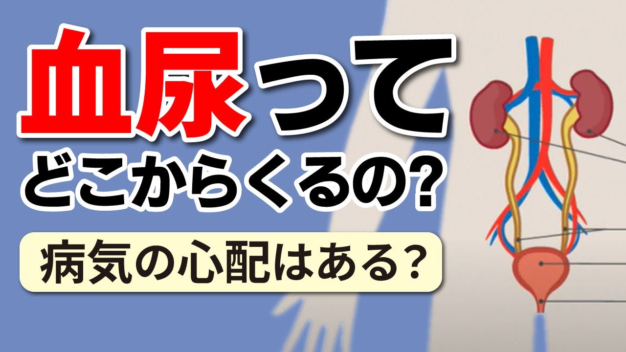 血尿とは？血尿はどこからくるの？【健康相談シリーズ】