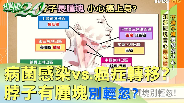 病菌感染vs.癌症转移？ 脖子有肿块别轻忽？ 健康2.0 - 天天要闻