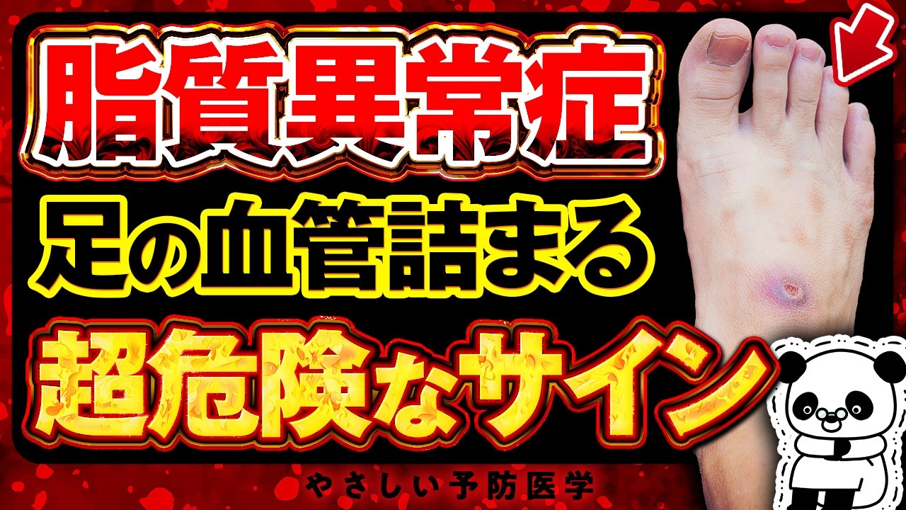 【超危険】放置厳禁！がんより死亡率が高い足の動脈硬化の危険サイン、足の動脈硬化の予防法について解説（足の血管　動脈硬化）