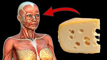 Ist Käse Gouda gesund?