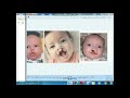 زراعة الاعضاء وعمليات التجميل