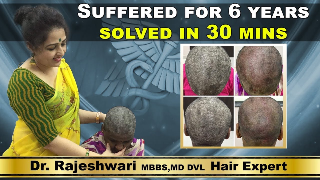 dr rajeshwari skin and hair clinic jubilee hills