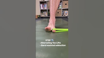 HOW TO FIX: Flat Feet, Plantar Fasciitis, Dropped Arch, and Over-Pronation