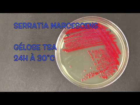 Video: Unterschied Zwischen E Coli Und Serratia Marcescens