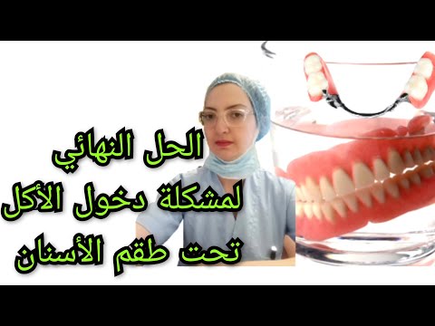 الحل النهائي لمشكلة دخول الأكل تحت طقم الأسنان المتحرك الكامل أو الجزئي   