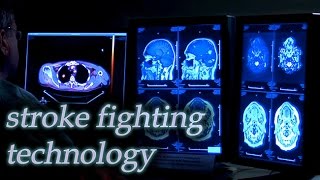 Stroke Fighting Technology