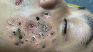 𝑺𝒐𝒐𝒕𝒉𝒊𝒏𝒈 𝑭𝒂𝒄𝒊𝒂𝒍 𝑻𝒓𝒆𝒂𝒕𝒎𝒆𝒏𝒕 𝒇𝒐𝒓 𝑺𝒕𝒓𝒆𝒔𝒔 𝑹𝒆𝒍𝒊𝒆𝒇 | 𝑫𝒆𝒆𝒑 𝑪𝒍𝒆𝒂𝒏𝒊𝒏𝒈 & 𝑪𝒂𝒍𝒎𝒊𝒏𝒈 𝑴𝒂𝒔𝒔𝒂𝒈𝒆 𝒂𝒕 𝑳𝒖𝒙𝒖𝒓𝒚 𝑺𝒑𝒂 #𝟓𝟖𝟖𝟐𝟓