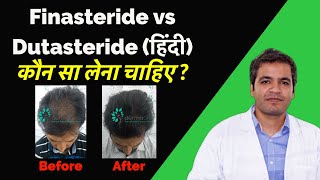 Finasteride vs Dutasteride: Hair Loss के इलाज के लिए better क्या है? और उनके Side Effects