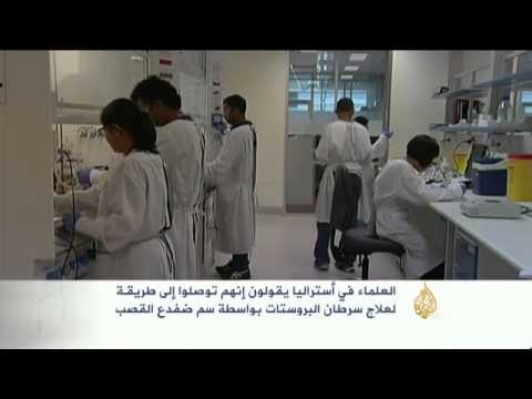 طريقة لعلاج سرطان البروستات بواسطة سم ضفدع القصب