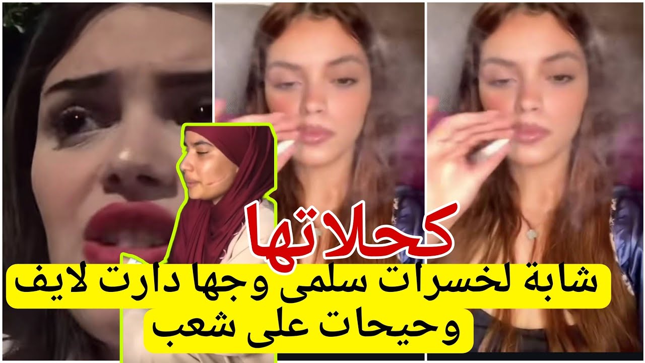 اول رد لشابة لخسرات وجه سلمى بمراكش  تكشف الحقيقة وسبب خلاف سمعو كلام لقالت 🙄