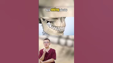 Răng hô nên niềng hay phẫu thuật  #bsck1buihonghiep