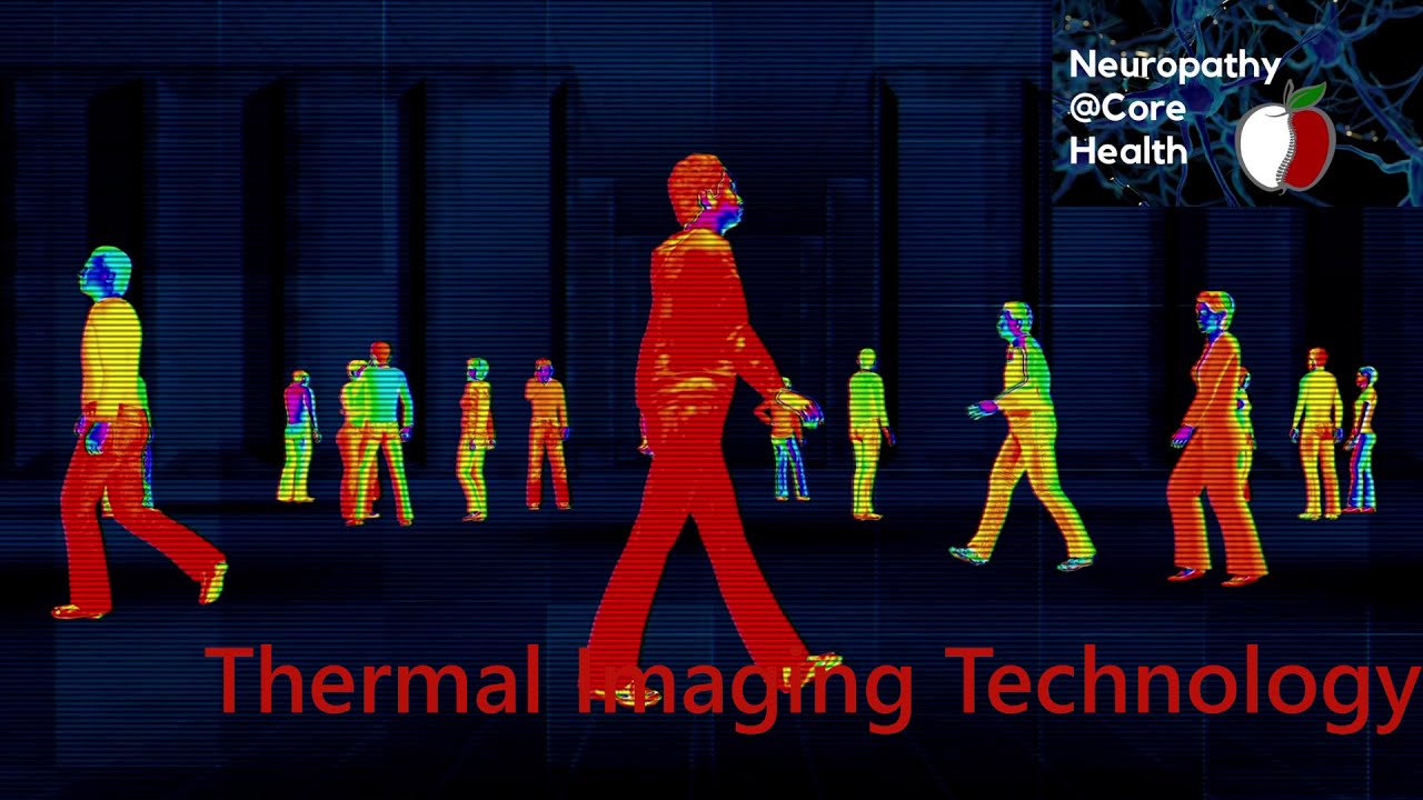 Thermal Imaging Scan NeuropathyCoreHealth YouTube