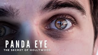 Panda Eyes: The Mystery Unveiled