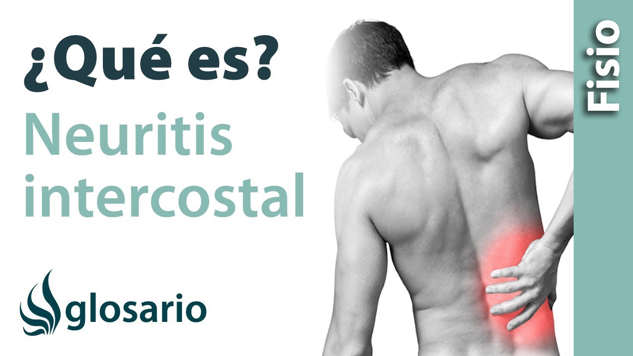 NEURITIS INTERCOSTAL Qué es, qué estructuras afecta, síntomas, signos, causas y tratamiento NEURITIS INTERCOSTAL Qué es, qué estructuras afecta, síntomas, signos, causas y tratamiento