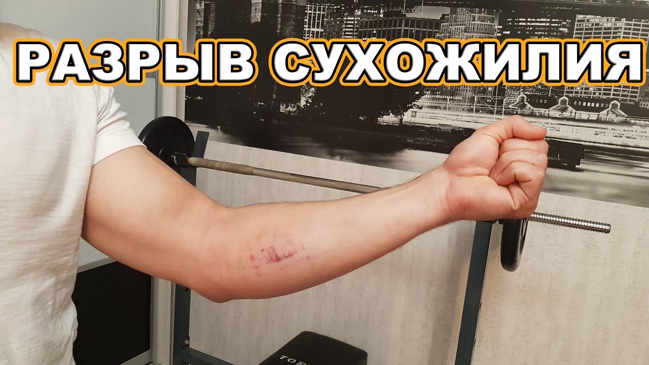 ПОРВАЛ БИЦЕПС! Что делать дальше?