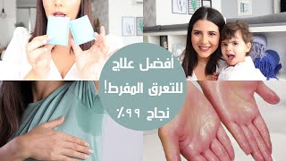 Struggling with excessive sweating? You need to see this incredible remedy!! screenshot 1