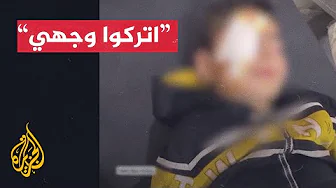 مناشدة لعلاج طفل فقد كامل أسرته في الحرب الإسرائيلية على غزة