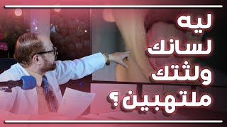 أسباب و طرق علاج قرح و بياض اللسان