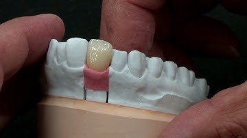 Staining and glazing Katana Zirconia YML with FC Paste Stain
