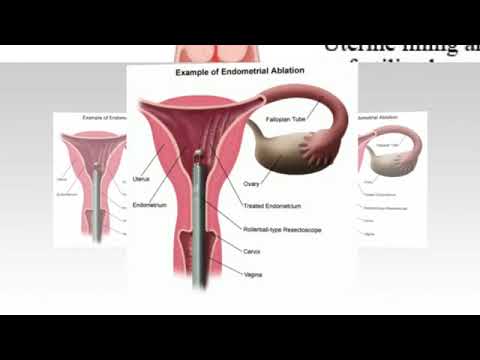 Effects of Progesterone on the Uterine Lining Gyn Issues The Women